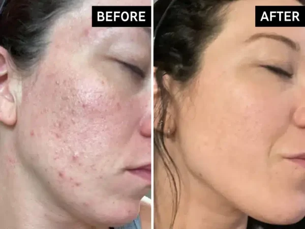 Routine Visage